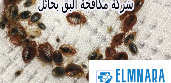 شركة مكافحة البق بحائل